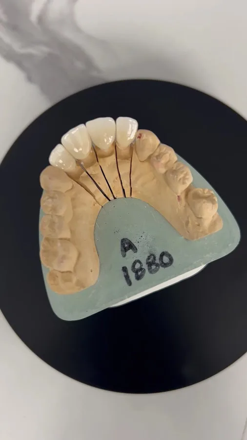 Laurel Smile Dentistry — photo 3