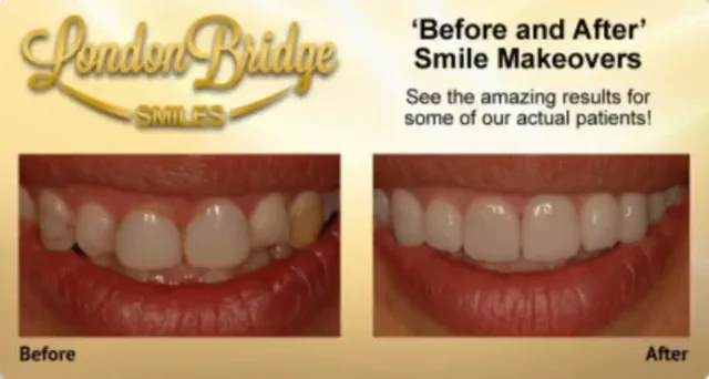 London Bridge Smiles — photo 3