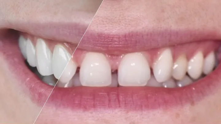 Luxe Dental Cosmetics — photo 3