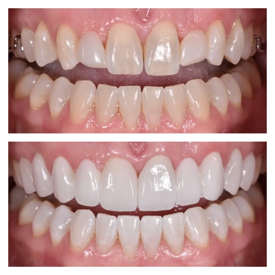 Murphey Dental Aesthetics — photo 3