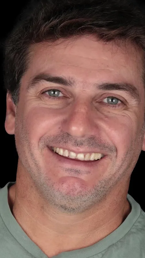 My Smile Miami — photo 4