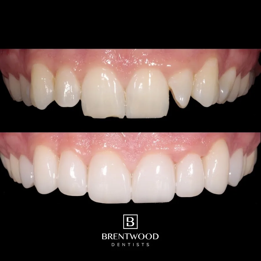 Nashville Aesthetic Dentistry — photo 5