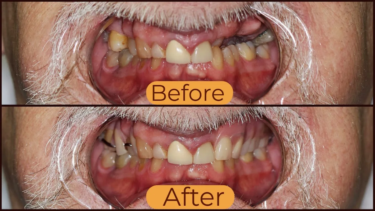 Natural Dental — photo 2