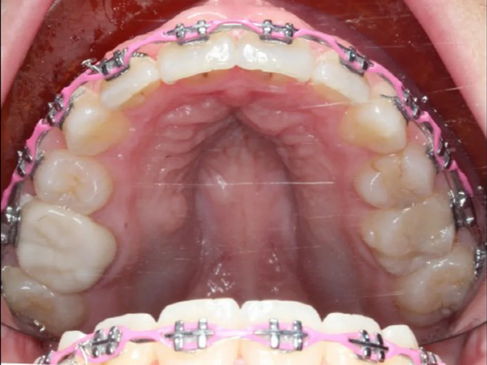 Normandy Lake Dentistry — photo 3