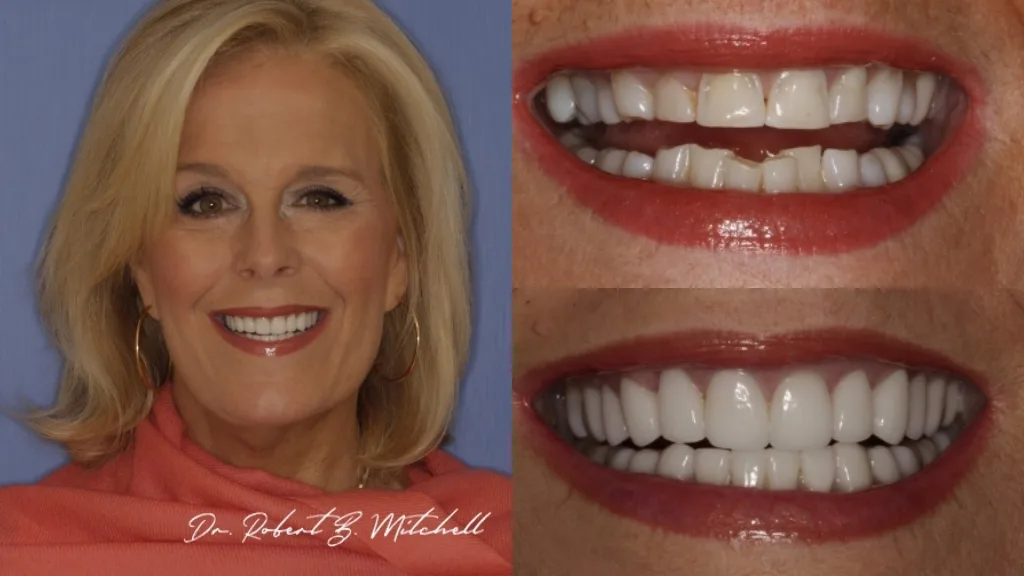 North Dallas Cosmetic Dentistry - Robert B. Mitchell — photo 2