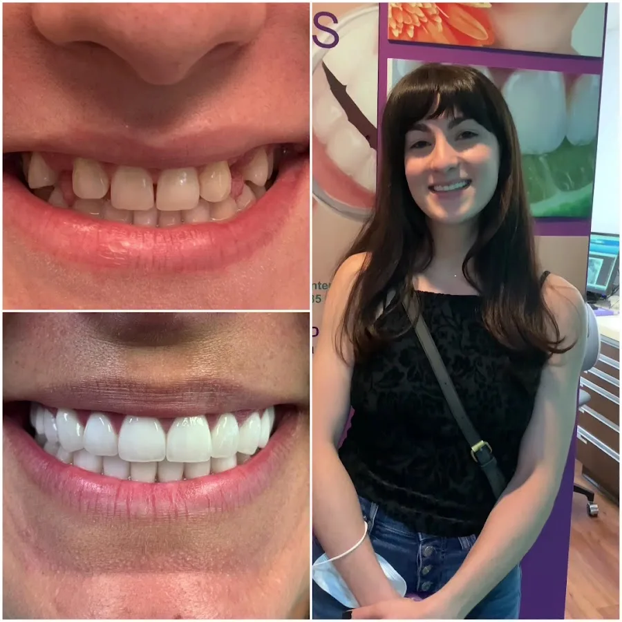 NÜVA Smile — photo 3