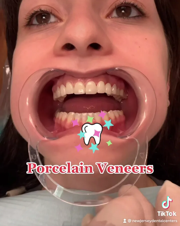 NÜVA Smile — photo 4