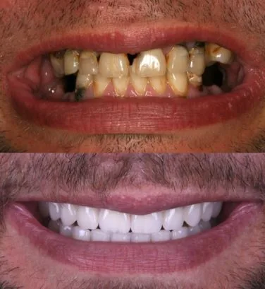 NuLife Dental: Cosmetic Dentist Orlando — photo 4