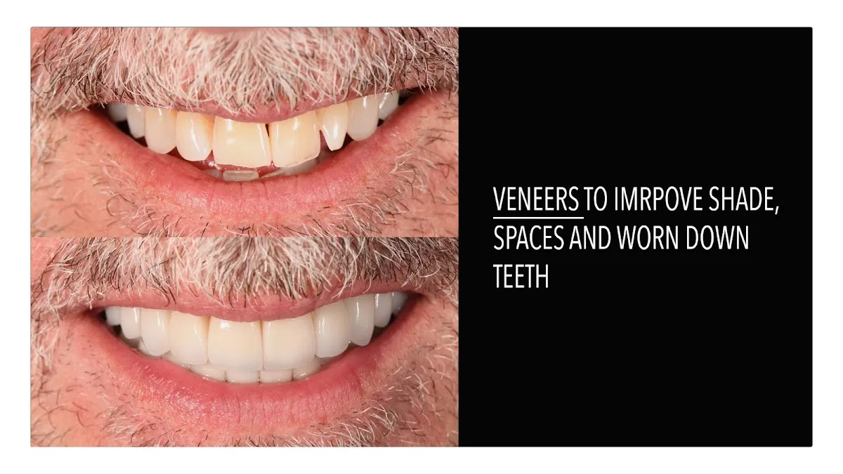 Olivia Moran, DDS | Veneers Dentist in San Francisco | ME Dental — photo 2