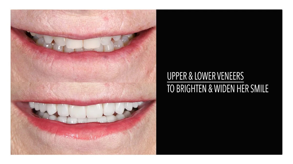 Olivia Moran, DDS | Veneers Dentist in San Francisco | ME Dental — photo 5
