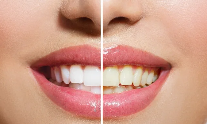 Olmos Park Family Dentistry — photo 3