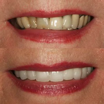 Paul M. Holliday, DDS, HollidaySmiles Dentistry