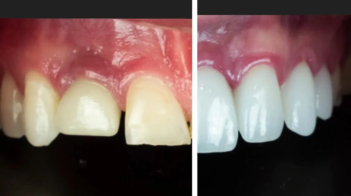 Pearce Dental Group of Cincinnati, OH — photo 3