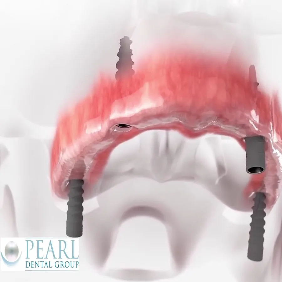 Pearl Dental Group & Dental Implant Center — photo 3