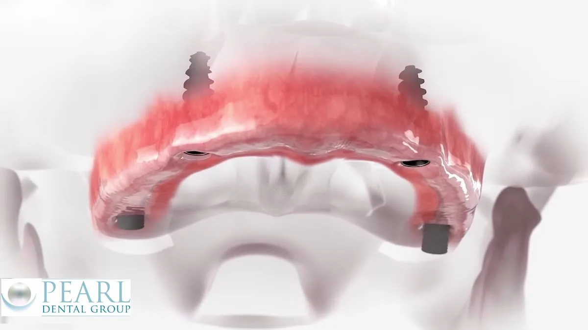 Pearl Dental Group - Jones Creek Rd. — photo 3