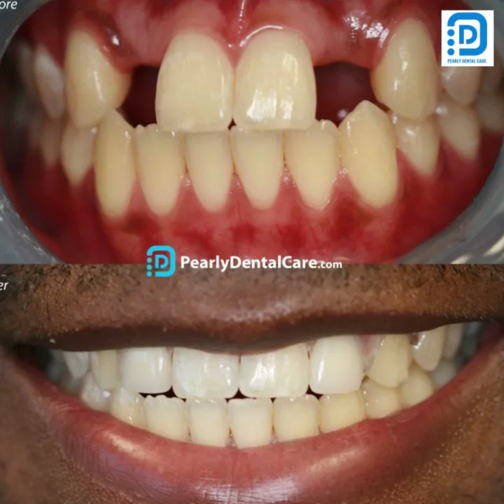 Pearly Dental Care San Jose — photo 2