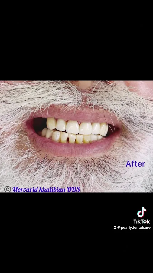 Pearly Dental Care San Jose — photo 3