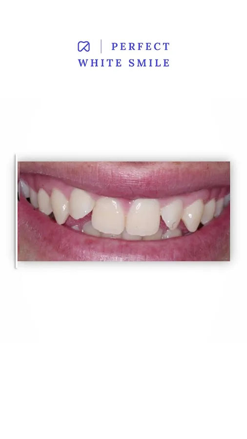 Perfect White Smile — David S. Frey, DDS Cosmetic Dentistry — photo 3