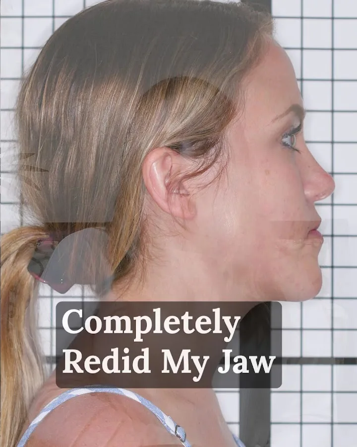 Perfect White Smile — David S. Frey, DDS Cosmetic Dentistry — photo 5