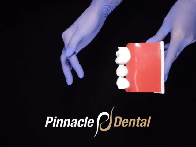 Pinnacle Dental - Dentist in Plano — photo 3