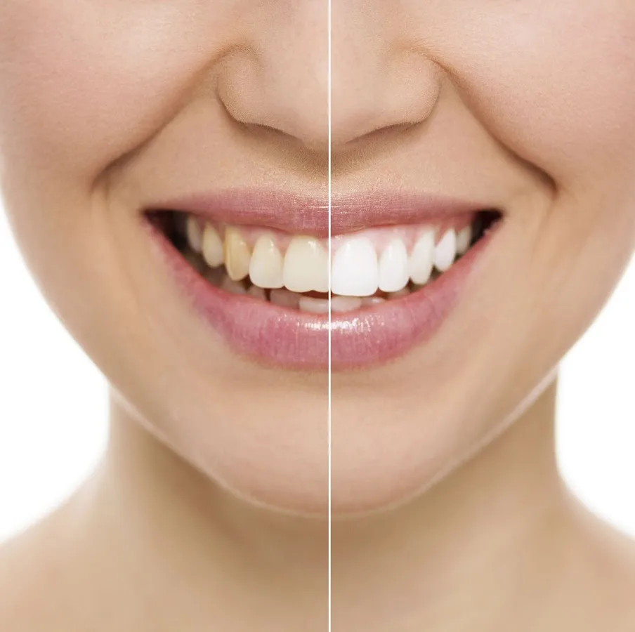 Precious Smiles Cosmetic Dentistry