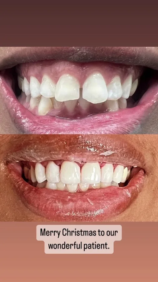 Prestige Dental Dallas & Implant Center — photo 3