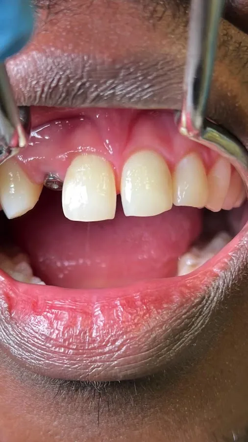 Prime Dentistry of Northeast Philadelphia — photo 3