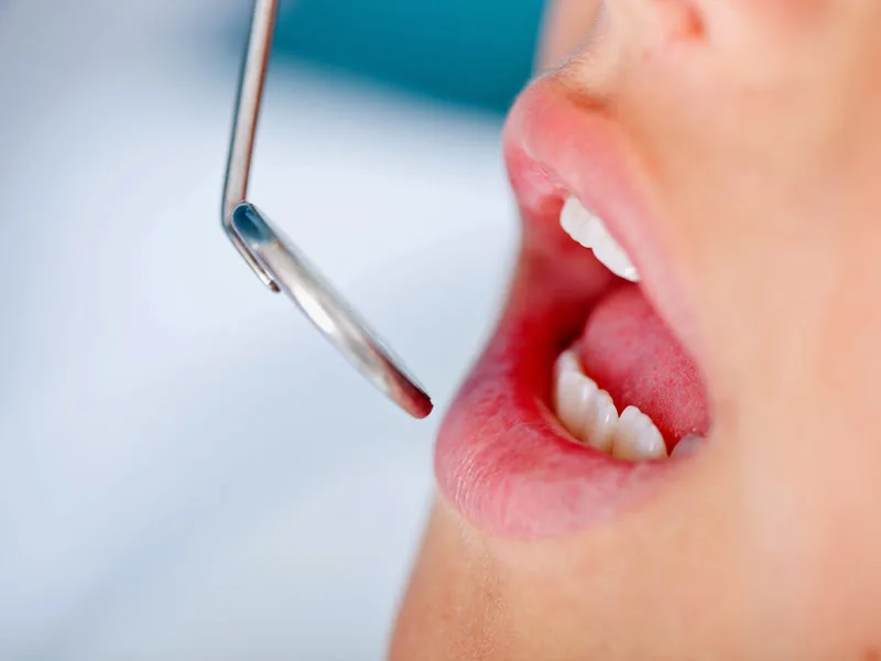 Prime Dentistry of Northeast Philadelphia — photo 4