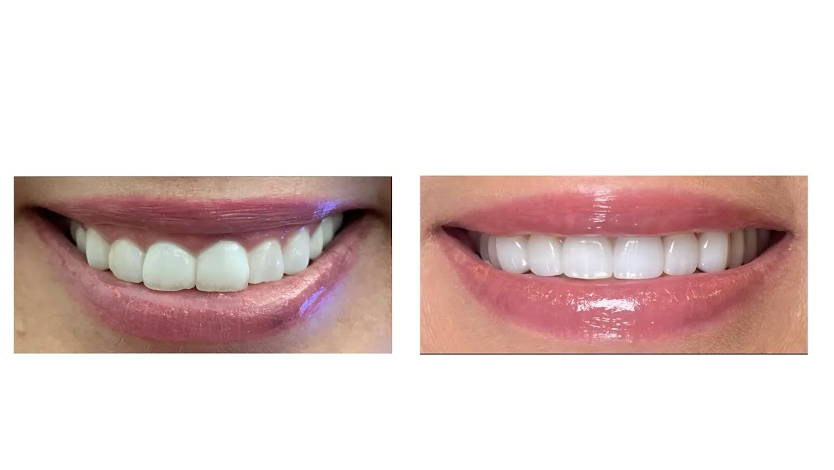 Pure Dental Health — photo 5