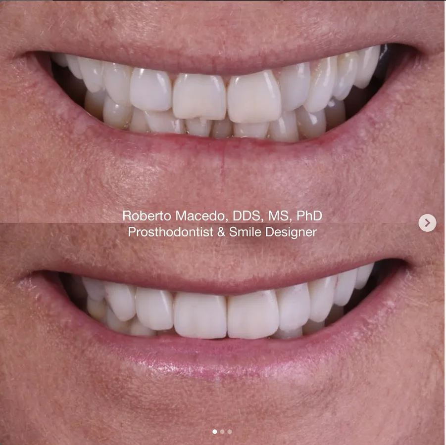 RM Advanced Center for Cosmetic Dentistry: Roberto Macedo, DDS, MS, PHD