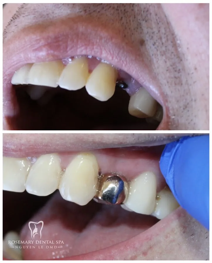 Rosemary Dental Spa — photo 2