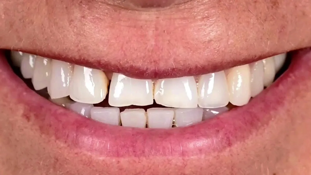 Royal Oak Family Dental of Oklahoma City — photo 5