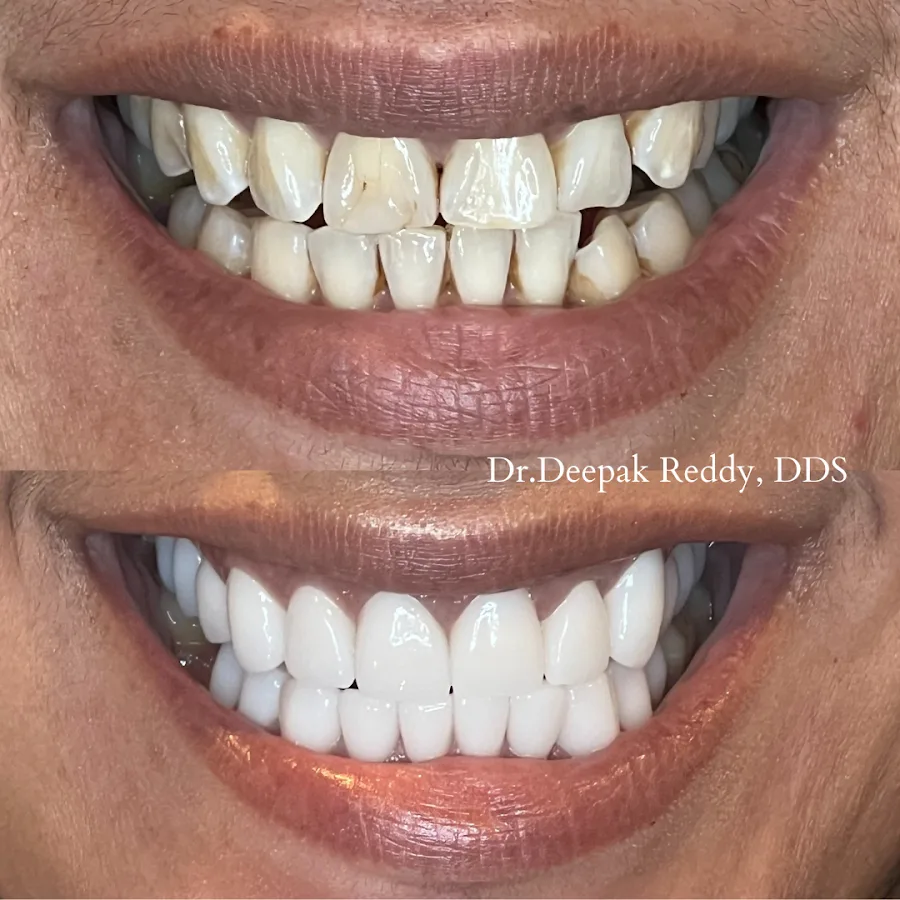 RR Smiles — photo 1