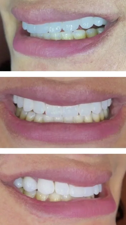 Sam Namdarian DMD, Fresno Smile Makeovers — photo 2