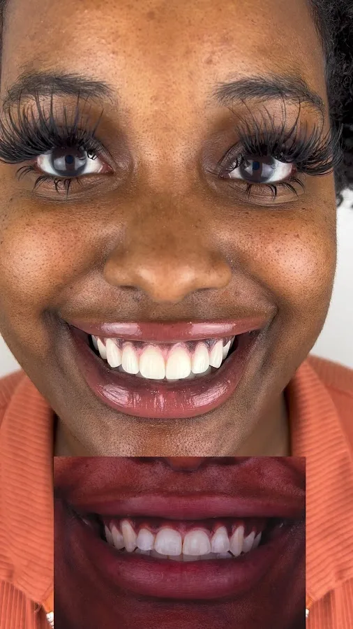 Sapphire Smiles - Dr. Antoun | Leading Cosmetic Dentist in Houston — photo 3