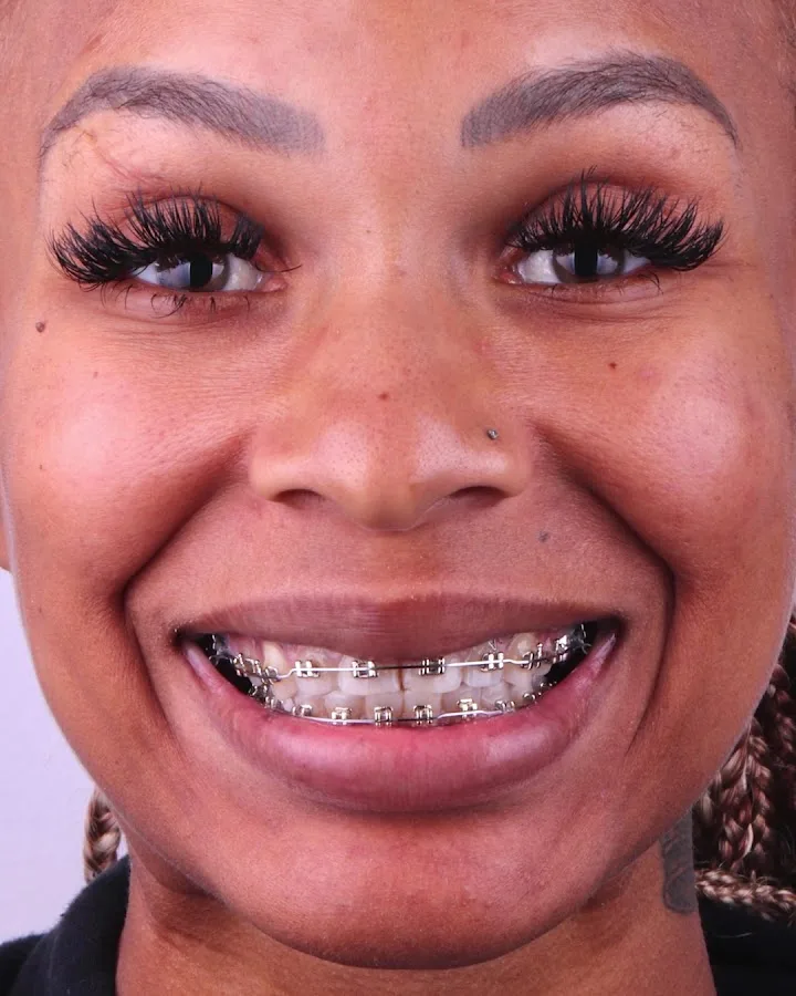 Sapphire Smiles - Dr. Antoun | Leading Cosmetic Dentist in Houston — photo 5