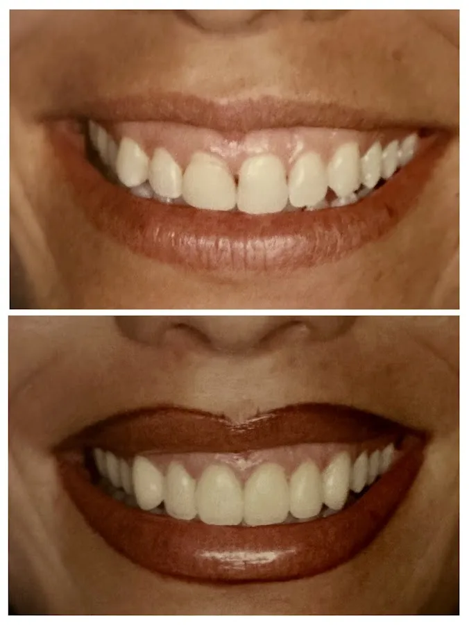Shine & Sparkle Dentistry - Dentist in Plano Texas | Cosmetic, Emergency and Implant Dentist in Plano Texas — photo 1