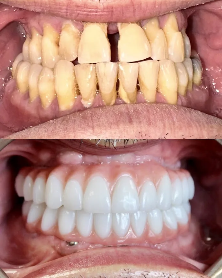 Signature Smiles Dental Implants and Cosmetic Dentistry — photo 1