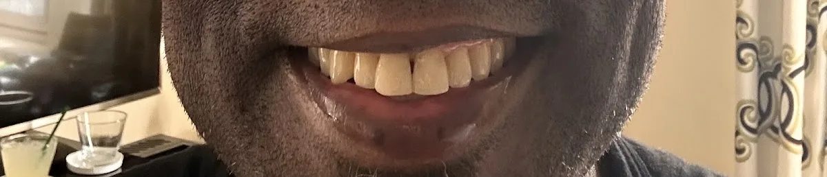 Smile 312 Chicago's Premier Dentist — photo 2