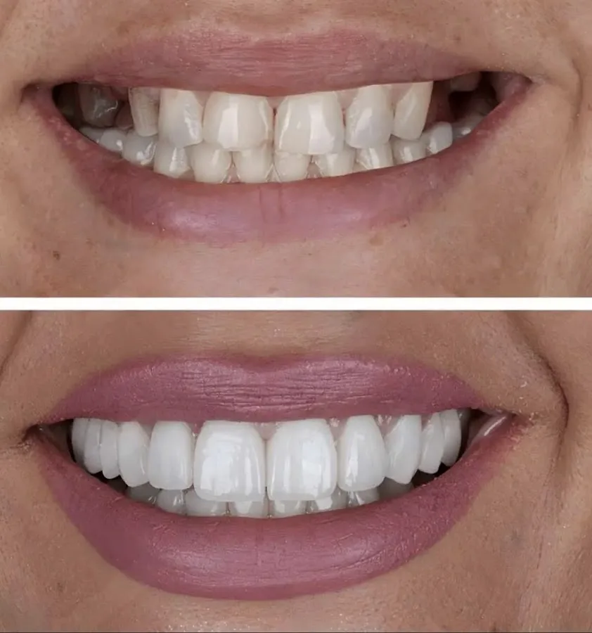 Smile Bright Dental Joliet — photo 3