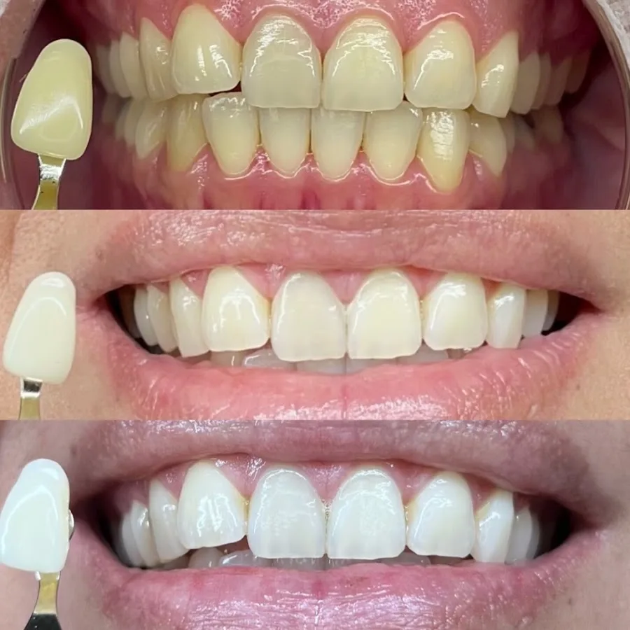 Smile Brite Dental — photo 5