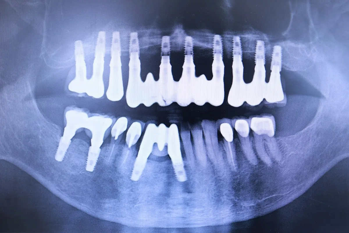 Smile Care - SC Dental Group Family Invisalign Emergency Dental Implants — photo 2