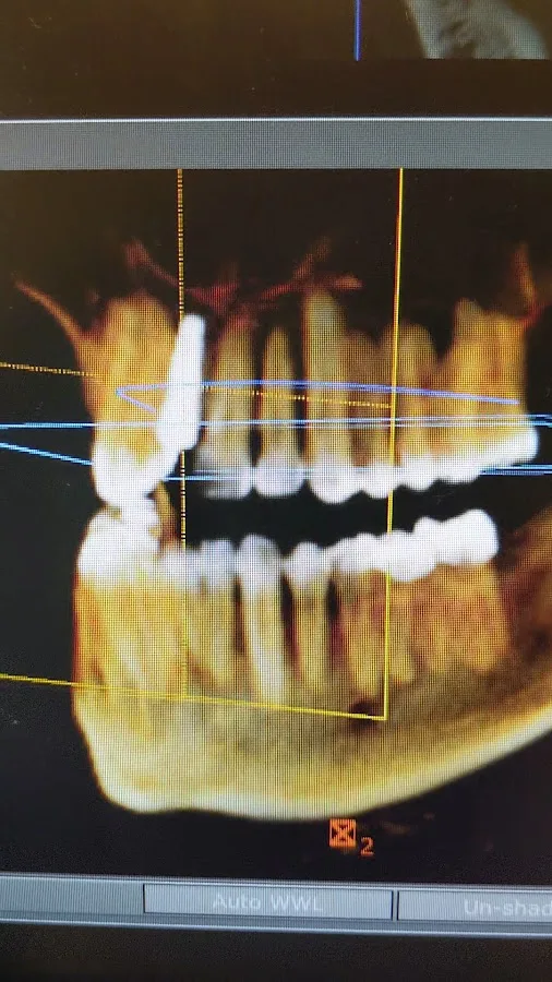 Smile Care - SC Dental Group Family Invisalign Emergency Dental Implants — photo 3