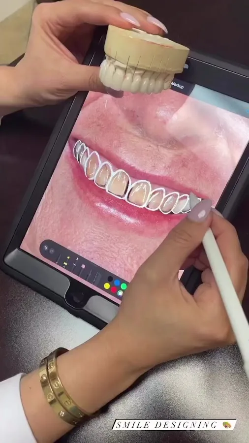 Smile Design Dental — photo 2