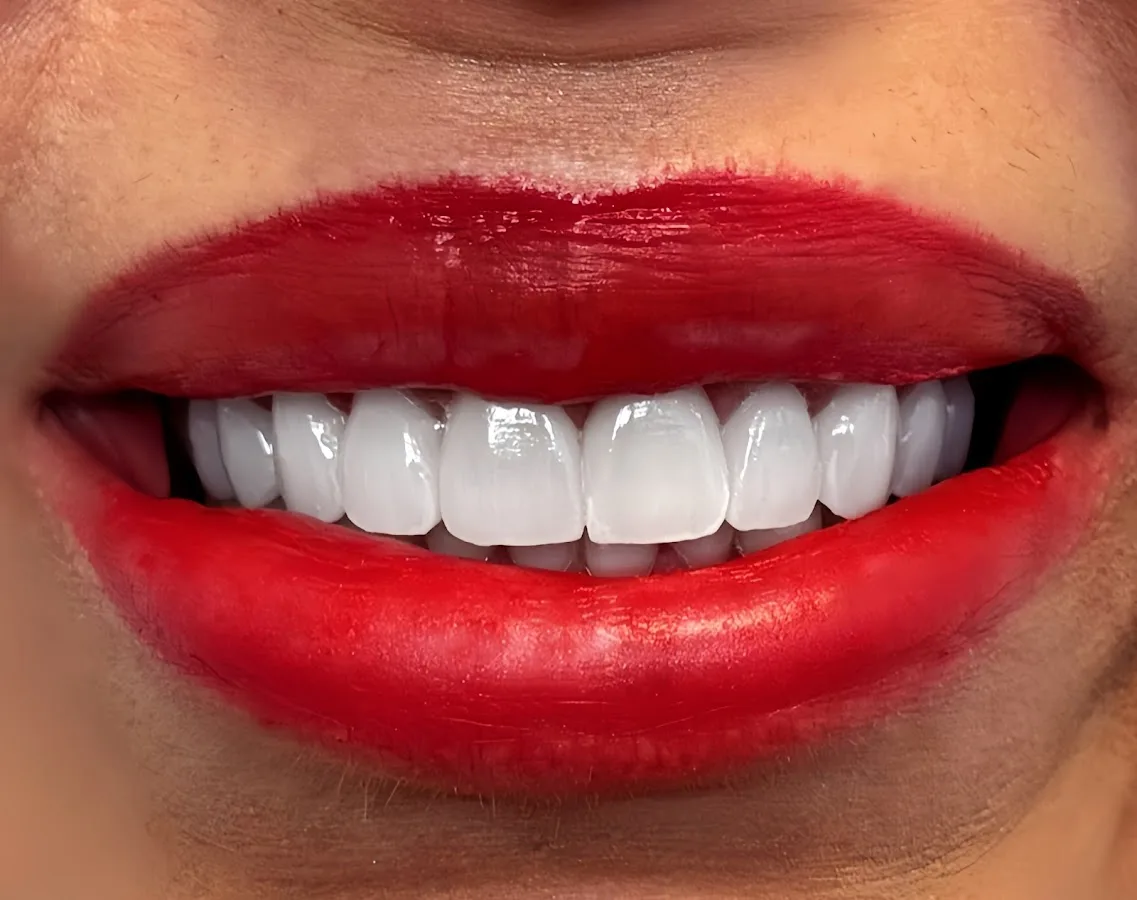Patient preparing documents and dental questions for a consultation