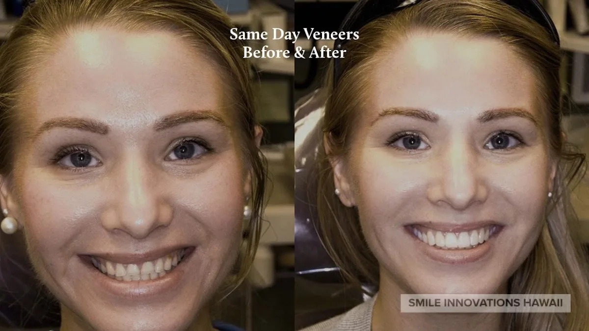 Smile Innovations Hawaii : DTR/TMJ - Cosmetic - Sleep Dentistry — photo 2