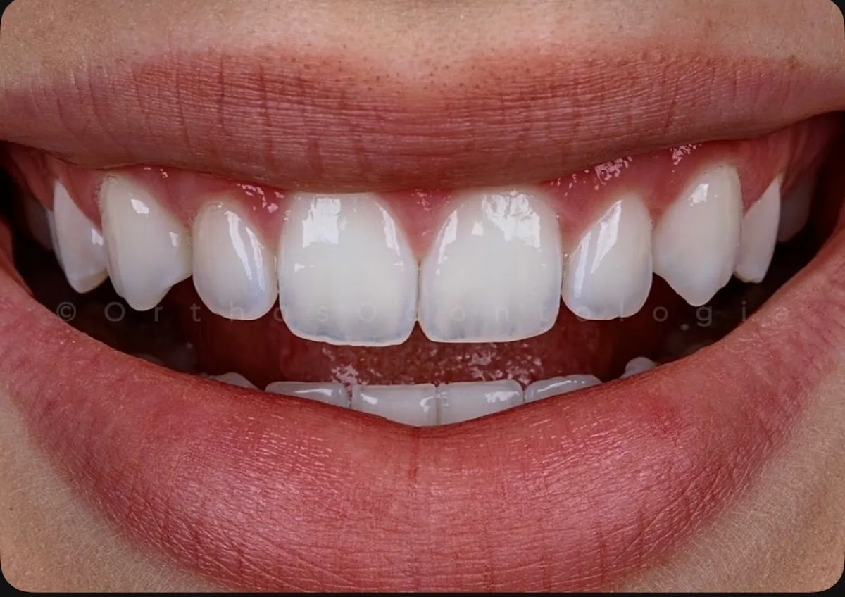 Smile Muse Spa — photo 1