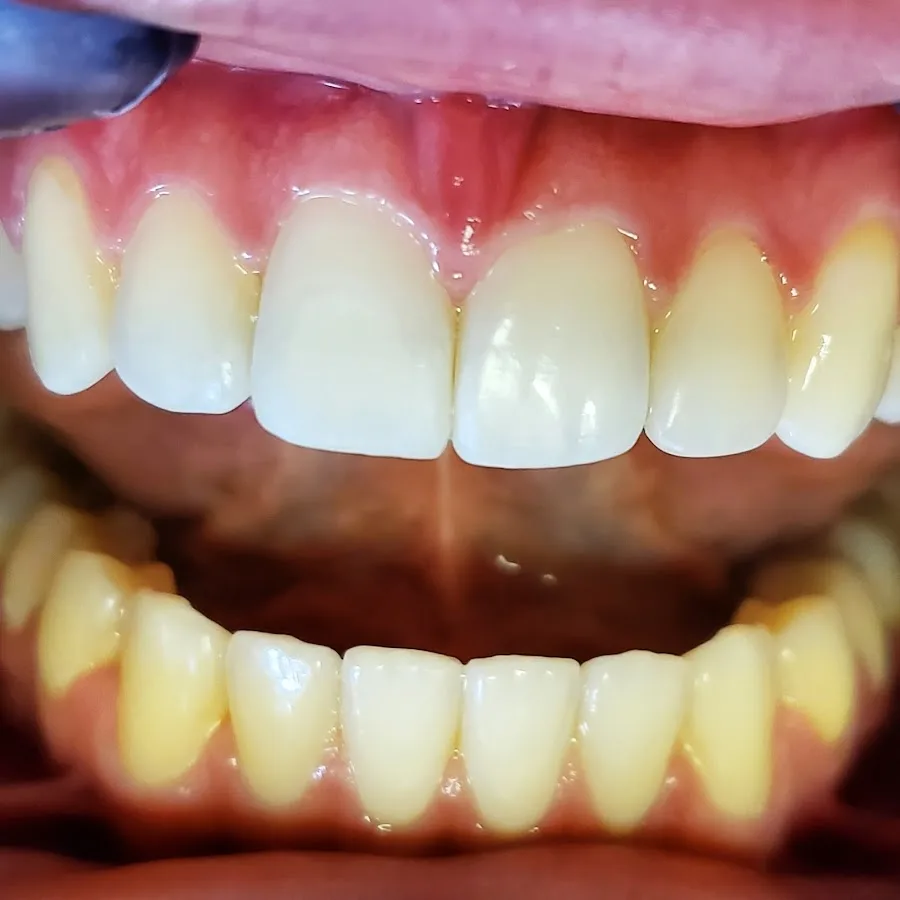 Smile N Shine Dental Care - Affordable Dentist In Orange — photo 5