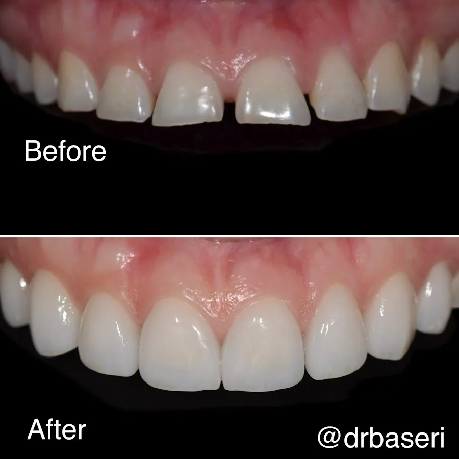 Smile Recreation Dentistry by Dr. Baseri — photo 1