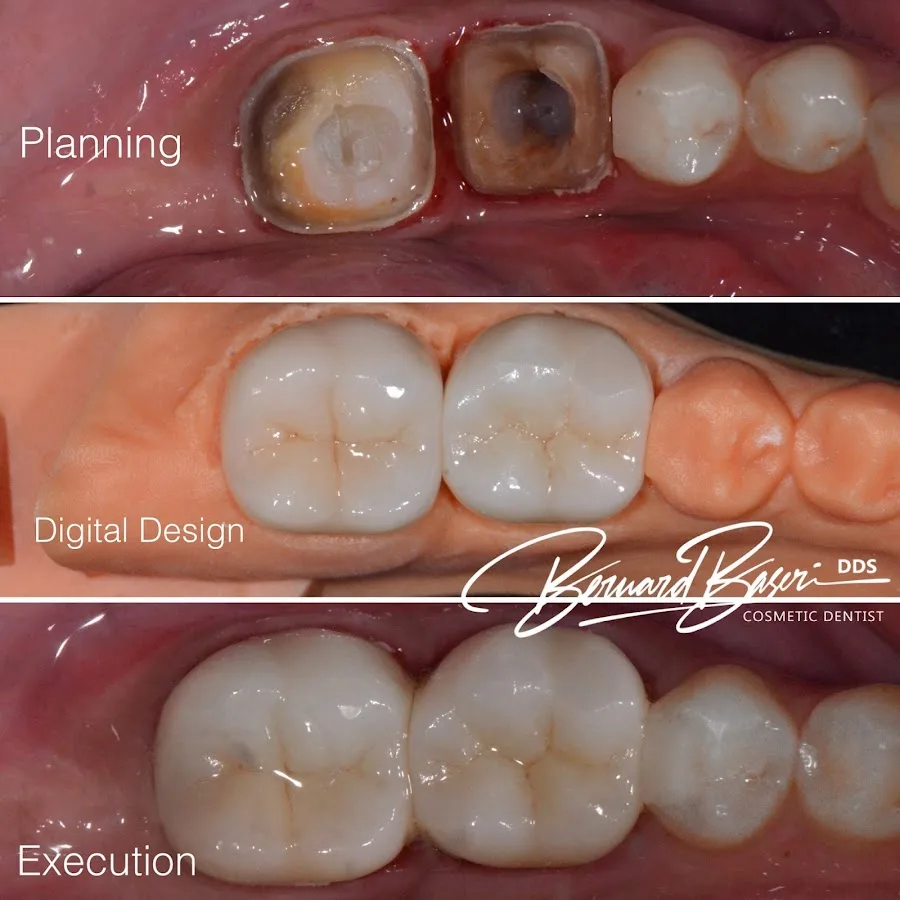 Smile Recreation Dentistry by Dr. Baseri — photo 2